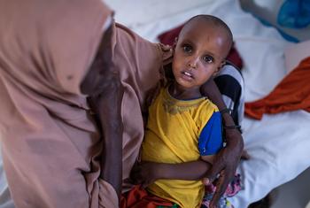 image350x235cropped 3 الجوع " يفتك " بأطفال الصومال .. ومنظمات دولية تطلق نداءات استغاثة