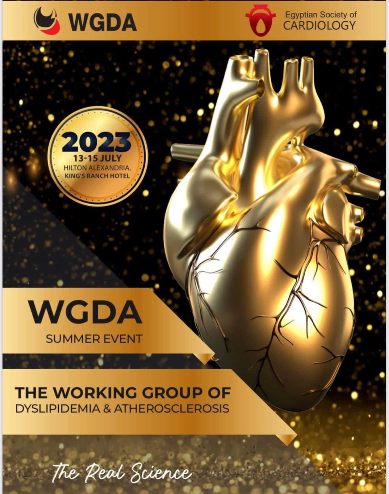 IMG 20230717 WA0029 «شعبة الكولسترول » بجمعية القلب المصرية تناقش في مؤتمرها السنوي استخدام الذكاء الاصطناعي في أمراض القلب