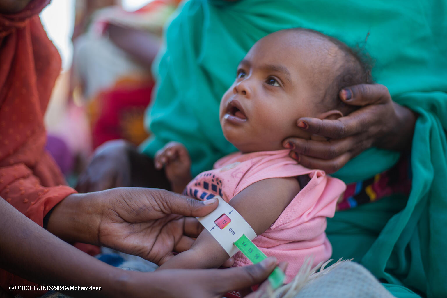 السودان يونيسيف : الجوع يضرب أطفال السودان .. وجيل مولر : 3.7 مليون طفل قد يعانون سوء التغذية الحاد