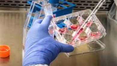 « الصحة العالمية »  تطلق تحذيرا .. انتشار جدري القرود في أفريقيًا يحتاج تحركا عاجلا  3 Screenshot ٢٠٢٤ ٠٦ ٢٦ ٠٠ ٣٦ ٤٧ ٣٣ 99c04817c0de5652397fc8b56c3b3817 « الصحة العالمية »  تطلق تحذيرا .. انتشار جدري القرود في أفريقيًا يحتاج تحركا عاجلا