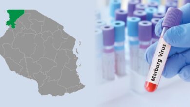 الاتحاد الأفريقي يدعم تنزانيا ب 2 مليون دولار لمكافحة تفشي مرض ماربورج 1 WhatsApp Image 2025 01 20 at 19.27.28 1024x496 1 الاتحاد الأفريقي يدعم تنزانيا ب 2 مليون دولار لمكافحة تفشي مرض ماربورج